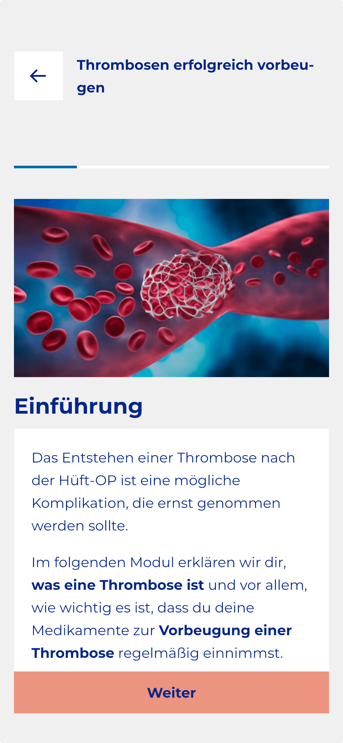 App-Screen: Wissensmodul zur Thromboseprophylaxe